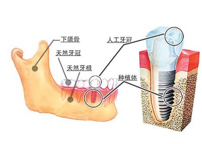 ݵȱʧֲ