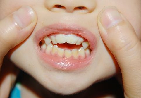幼儿口腔护理的方法还有哪些呢