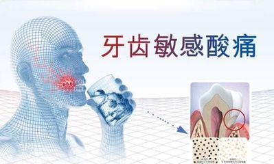 牙齿敏感