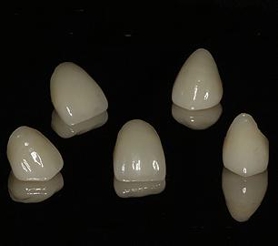 漳州全瓷牙需要多少钱