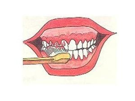漳州牙龈出血怎么办