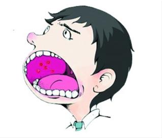 漳州口腔溃疡要怎么预防